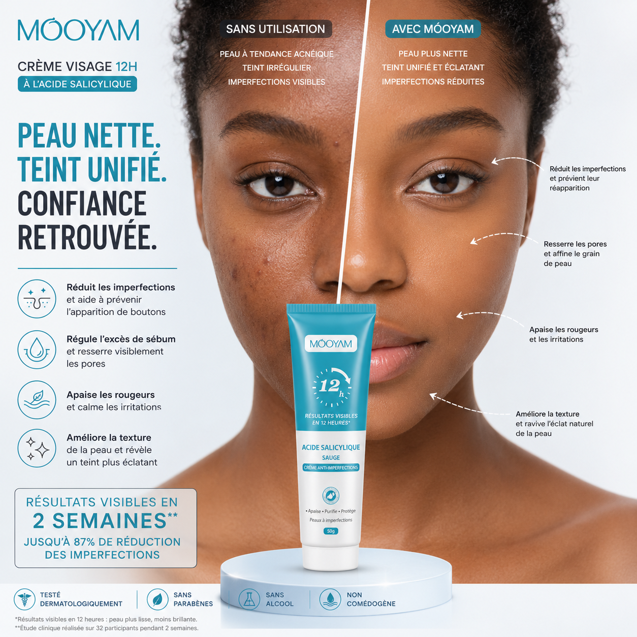 Crème Anti-Acné Visage 12H